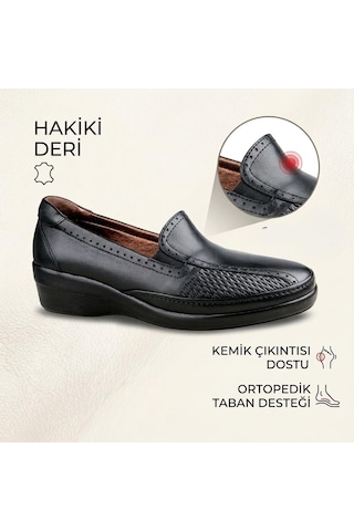 Ceyo 9920-32 Kadın Hakiki Deri Kemik Çıkıntısı Destekli Günlük Ayakkabı Siyah