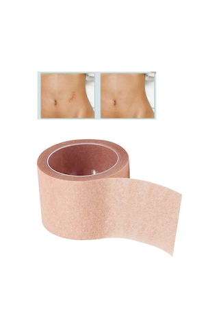 Suntek Kusur Kapatma Bandı Nefes Alabilir 5m Uzunluk Yaması