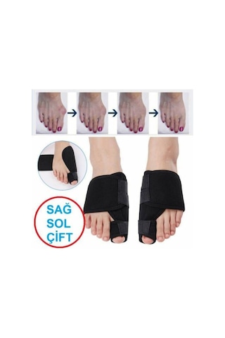 Halluks Valgus Gece Ateli Ayak Baş Parmak Kemik Çıkıntısı