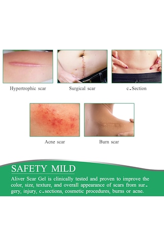 10-50 Cm Silikon Yara Izleri Yama Yara Bandı Sivilce Yanık Yara Izi Tedavisi Kapak Kulak Düzelticiler Verimli Onarım Hasarlı Cilt Levha