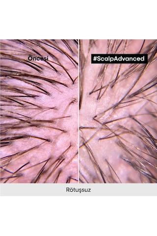 L'Oréal Professionnel Scalp Advanced Hassas Saç Derisi İçin Şampuan Refill 500 ML