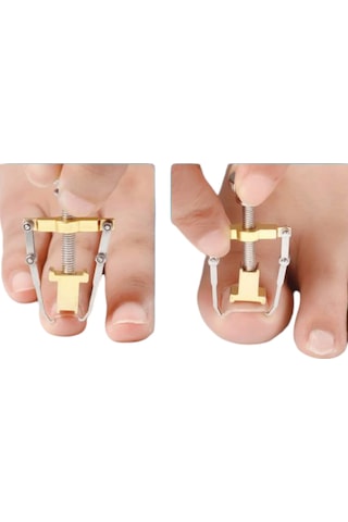 Akestoria Med Batık Tırnak Çıkarıcı Ve Düzeltici Aleti Fc-037 Standart