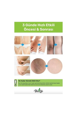 İlla Life Koltuk Altı ve Bikini Bölgesi Beyazlatıcı Krem 50 ML