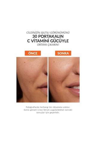 Anew Vitamin C Canlandırıcı Serum 30 Ml.