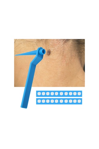 Hangfox 50 Adet Mavi Cilt Etiket Kaldırıcı Aleti - 4-8mm Büyük Boy Lastik Bantlı Bakım Aracı