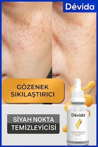 Devida Siyah Nokta Akne Gözenek Sıkılaştırıcı Vivo Series A210 30 ML
