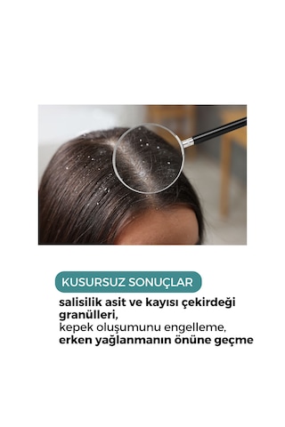 Zento Sebum Oıl Dandruff Haır Peelıng 150 Ml