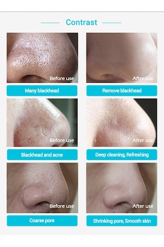 Lanbena Siyah Nokta Temizleme Maskesi 30 G