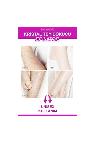 Kristal Tüy Dökücü Ağda Epilatör Crystal Eraser Epilasyon Aleti Tüy Silgisi Tüy Alıcı Fiziksel Pembe
