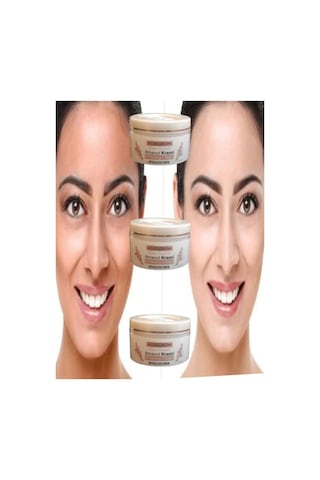 Northcity Arnavut Aklık Ciltte Renk Acıcı Beyazlatıcı Bakım Kremi 100 Ml X 1 Adet