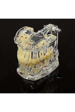 Skycity Diş Hekimi Ve Öğrencilere Özel Reçine Diş Patoloji Gösterim Modeli 1 Adet