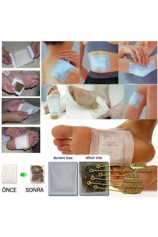 Mobgift Mobgift Detox Ayak Bandı