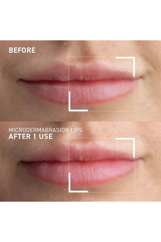 Dr. Brandt Microdermabrasion Smoothing Lip Exfoliator Dudak Peelingi
