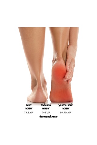 Dermanel Nasır Tedavi Seti 45 ML