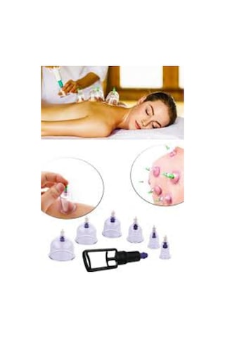 Hacamat Kupası 10 Adet 7 Cm 1.Kalite + Hacamat Pompası