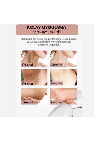 Cilt Beyazlatıcı Doğal Bitkisel Pirinç Sabunu 100 Gr