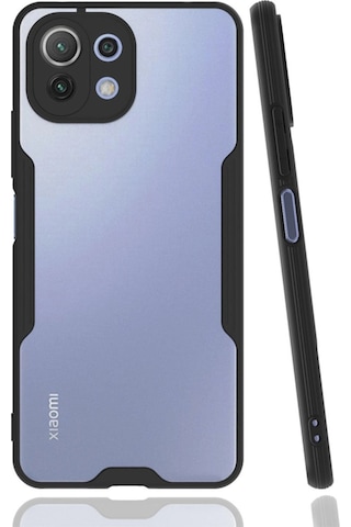 Xiaomi Mi 11 Lite Kılıf Platin Silikon - Siyah -