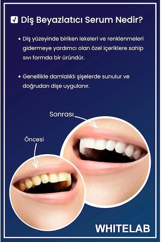 Whitelab Diş Beyazlatıcı