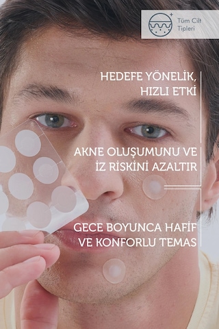 The Purest Solutions Microneedle Teknolojili Akne Bant, Akne Karşıtı Yama, Mikroiğneli Bant, 9'lu