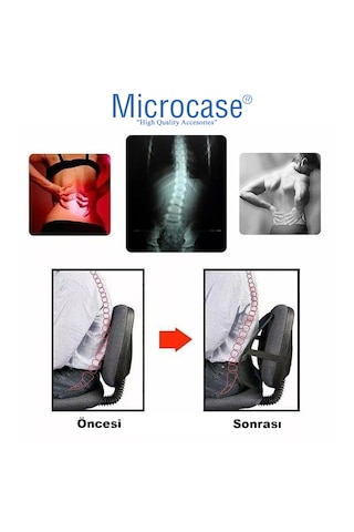 Microcase Ortopedik Sırt Bel Minderi Fileli Destekli Ayarlanabilir Araba Koltuk Sandalye 1 Adet Al5380 Siyah
