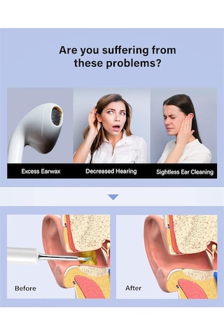 Bebırd T5 3mp Kamera 3.5mm Lens Şarjlı Wıfı Görüntülü Kulak Temiz