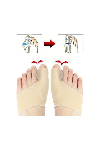 Akestoria Med Baş Parmak Kemik Düzeltici Ve Koruyucu Makarlı Unisex Fc-038 L