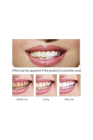Lanbena Diş Parlatıcı Beyazlatıcı Solüsyon Diş Taşı ve Leke Temizleyici 10 ML
