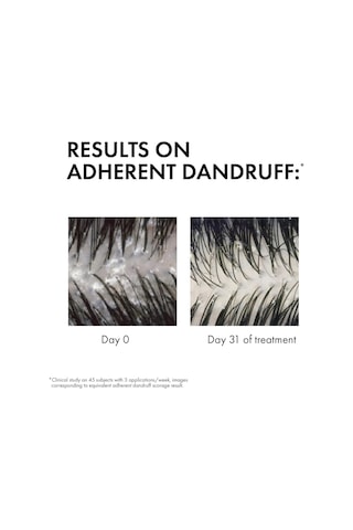 Vichy Dercos Anti-dandruff Kepek Karşıtı Bakım Şampuanı - Kuru Saçlar 390 Ml Beyaz