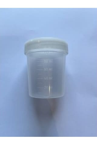Non-steril İdrar Numune Kabı -100 Ml