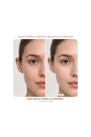 Vàlıen Pirinç Tanecikli Yüz Peelingi Beyazlatıcı 150 Ml