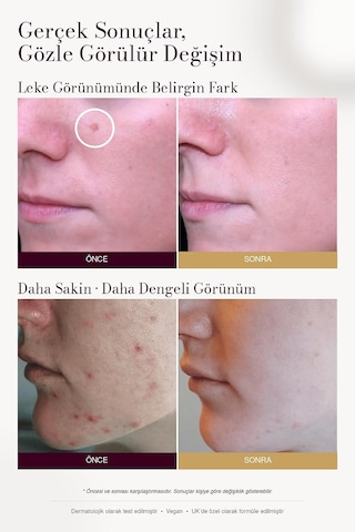 Leke Karşıtı Ve Aydınlatıcı C Vitamini Serum 30ml Arbutin, Tranexamic Asit, Niacinamide, Hyalüronik Asit - Gözenek Sıkılaştırıcı Etki