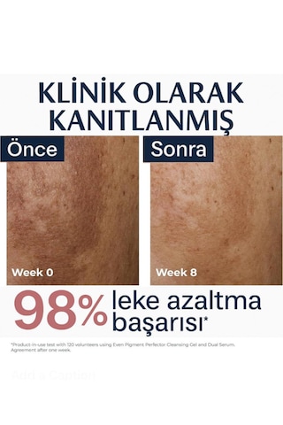 Eucerin Even Pigment Perfector Dual Serum 30 Ml Leke Karşıtı, Cilt Tonu Eşitleyici Ve Kırışıklık Karşıtı Yüz Serumu