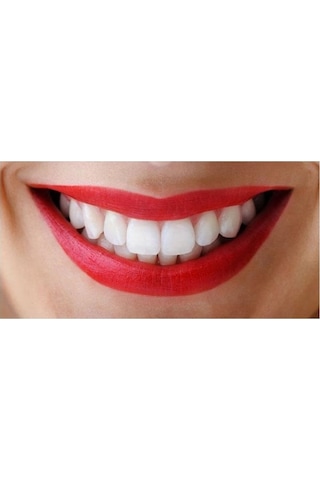 Diamond Dental Diş Beyazlatma ve Parlatma Kremi 110 G