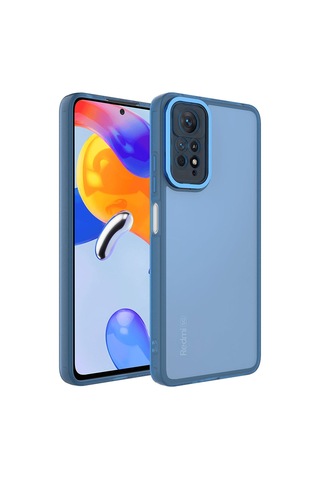 Xiaomi Redmi Note 11 Pro 5g Kılıf Kamera Korumalı Transparan Zore Post Kapak Mavi