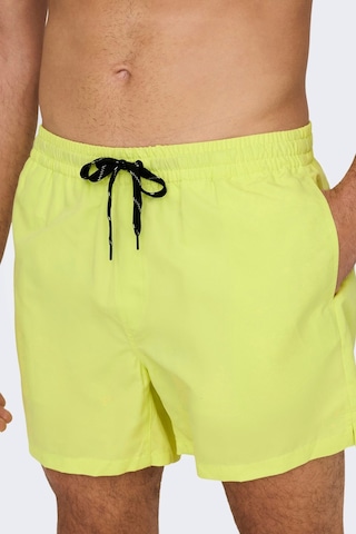 Only & Sons Erkek Onsted Deniz Şortu 22021832 Limon Narçiçeği