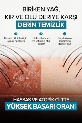 Saç Derisi Peelingi Arındırıcı Ve Dengeleyici Hair Scrub 200 Ml Tüm Saçlar