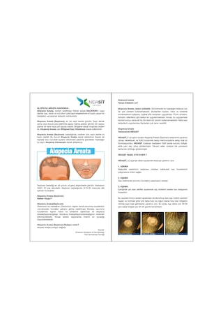 Nidasit Saçkıran Sakalkıran Losyonu 50 G