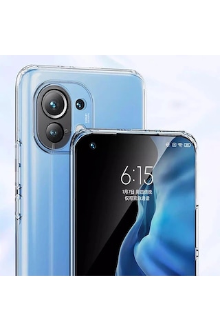 Hepsi Gor Xiaomi Mi 11 Kılıf Kamera Korumalı Şeffaf Silikon Kılıf- 5775 Najmaddin