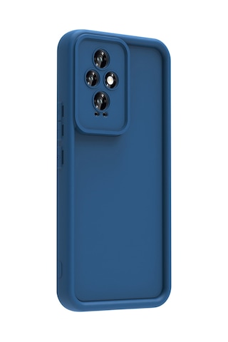 Zore Honor 200 Kılıf Kamera Korumalı Msra Ananas Kapak - Siyah Siyah