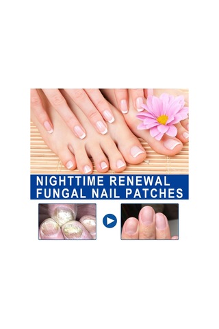 Yifomall 32 Adet Onyxomykoz Ve İçine Giren Tırnak Tamir Bandı - Su Geçirmez, Nefes Alır, Tırnak Büyüme Açısını Düzeltir Bakım Bandı