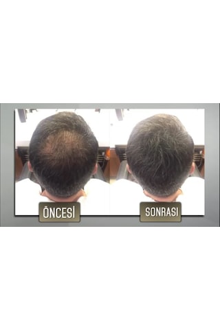 Jaja Fibers Saç Dolgunlaştırıcı Saç Fiberi Topik 50 Gr Siyah 2 Li