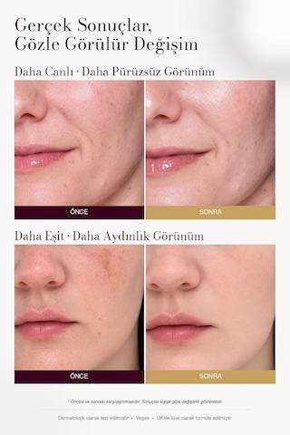 Leke Karşıtı Ve Aydınlatıcı C Vitamini Serum 30ml Arbutin, Tranexamic Asit, Niacinamide, Hyalüronik Asit - Gözenek Sıkılaştırıcı Etki