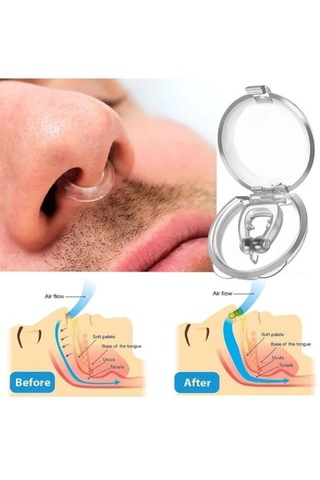 Horlama Önleyici Burun Klipsi Horlama Cihazı Burun Aparatı 2 Ür