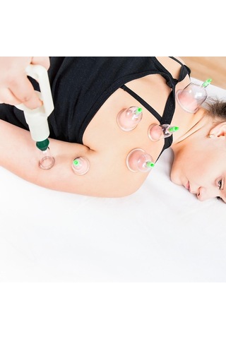 Samdoo 12 Bardaklı Profesyonel Vakum Şişe Seti - Kas Gevşetici, Kan Akışını Artırıcı Akupresür Masaj Aleti Çok Renkli