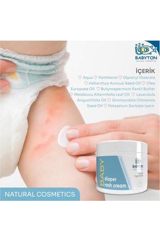 Babyton Pişik Önleyici Krem 50 ML
