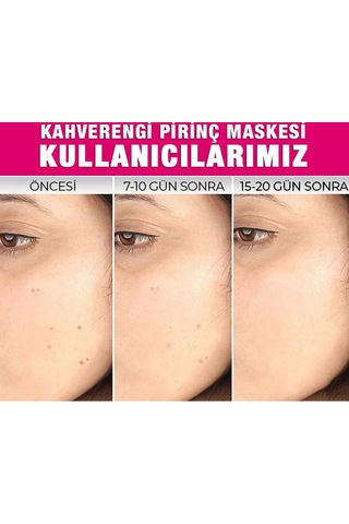 Kahverengi Pirinç Maskesi
