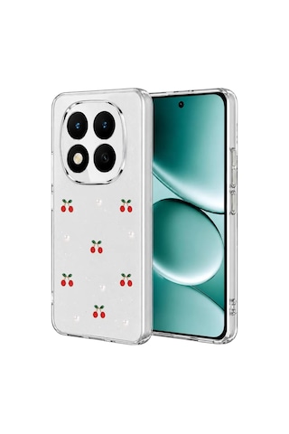 Note 15 Pro Plus 5g Fiyonk Desenli Kapak - Desen 9