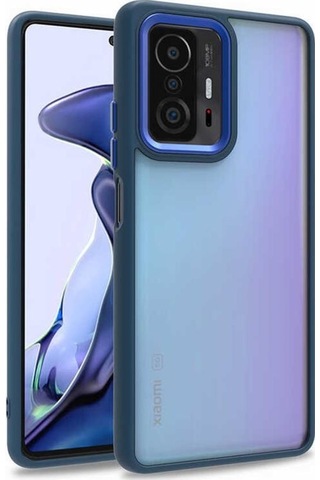 Xiaomi Mi 11T Pro 5G Kilif Kamera Korumali Mat Renkli Silikon 551649471