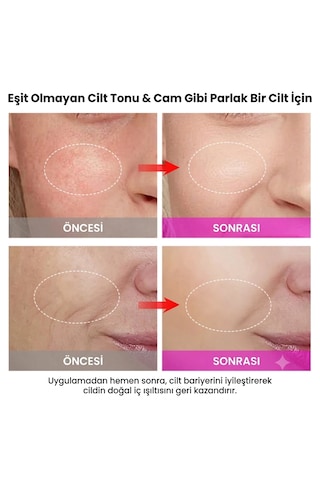 Premium 2 Si 1 Arada Çift Taraflı Rf Ve Ems Yüz Sıkılaştırıcı Ve Kırışıklık Azaltıcı Cihaz Profesyonel Yüz Gençleştirme, Lifting, Anti-aging Cilt Bakım Cihazı