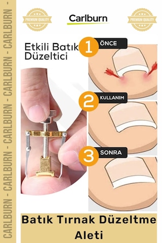 Özel Üretim Ayak Tırnağı Ağrısı Giderici Düzeltici Evde Güvenli Kolay Bakım Batık Tırnak